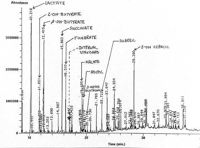 gas chromatograph